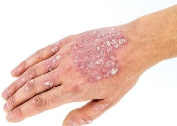 Comprehensive Skin Health: A Guide to Treatment and Aesthetics in Lakewood