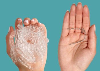 Are You Considering Invisalign Clear Braces in Thousand Oaks CA for Your Smile?